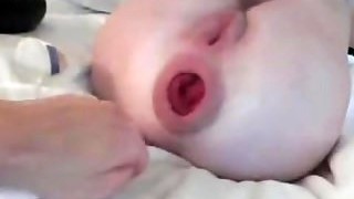Extreme Anal Fisting